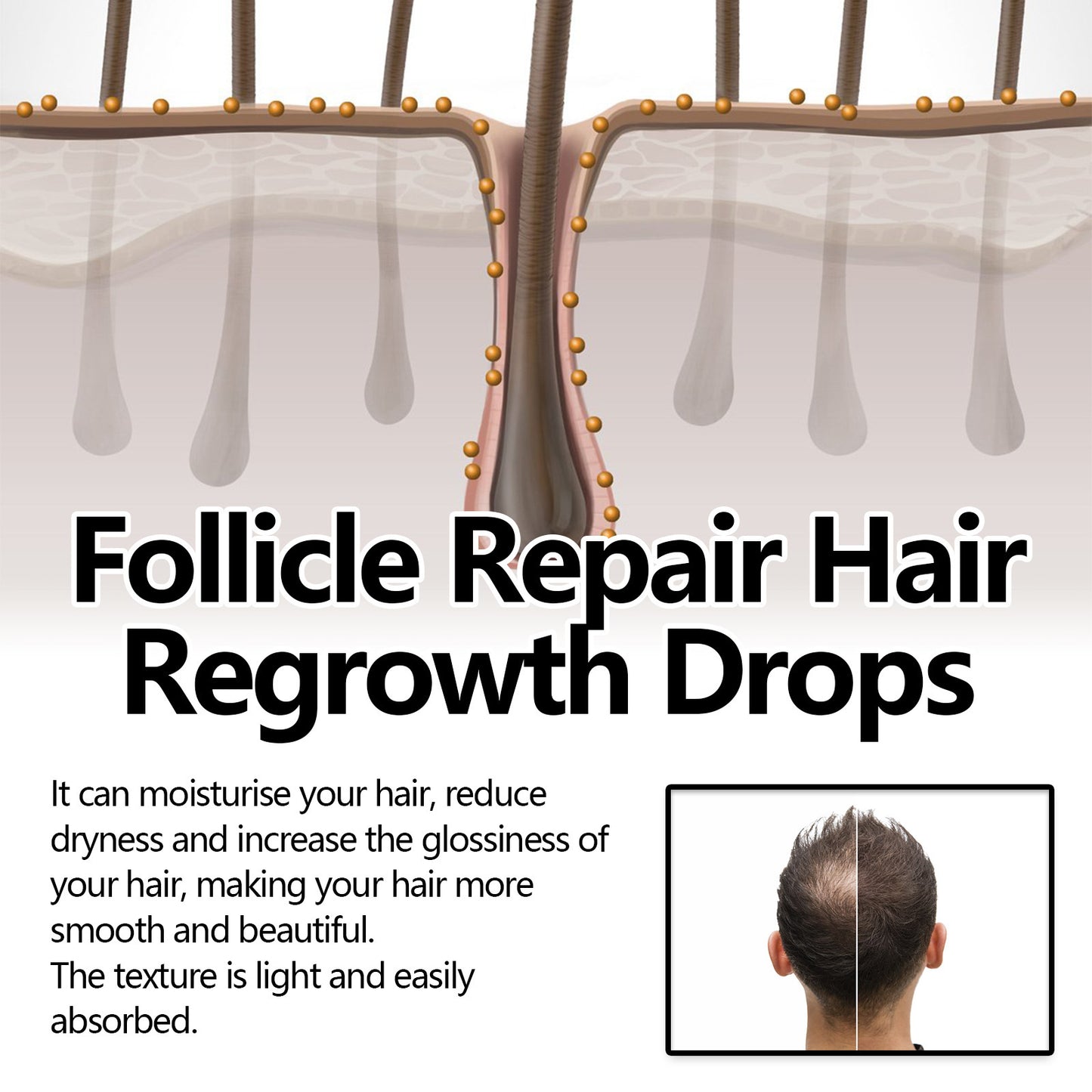 Thick Hair Hair Anti-fall Strong Hair Fixing Serums