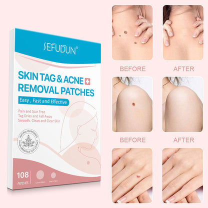 Acne Skin Tag Remover Beauty Acne Patch Wart Removal Stickers Removal Care Invisible Blackhead Skin Patch