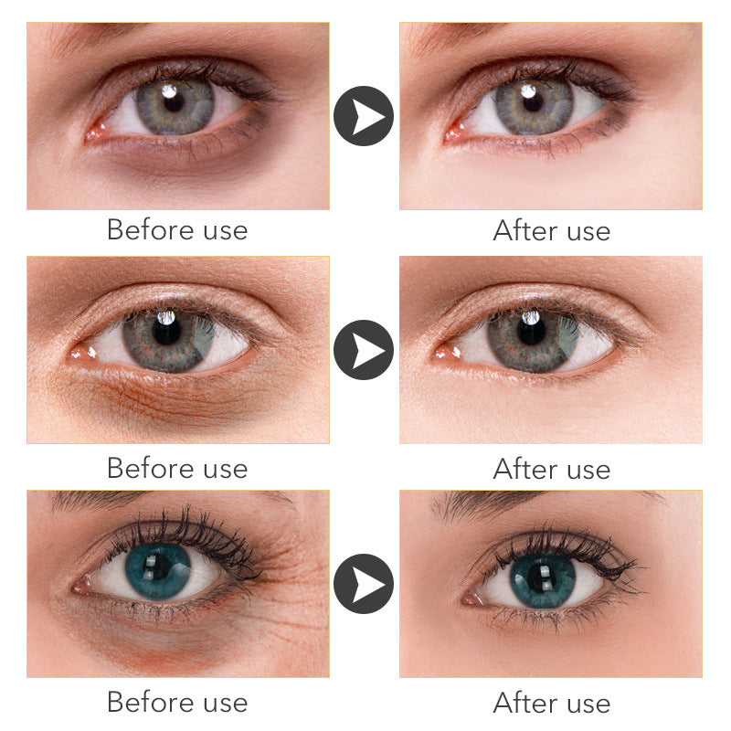Beauty Eye Cream30mlwish Women's Skin Care Products